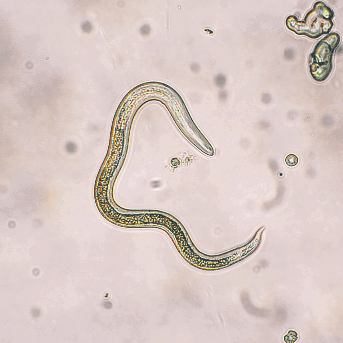 Close-up of tiny parasitic worm, microscopic view, biological illustration, disease research, scientific image.