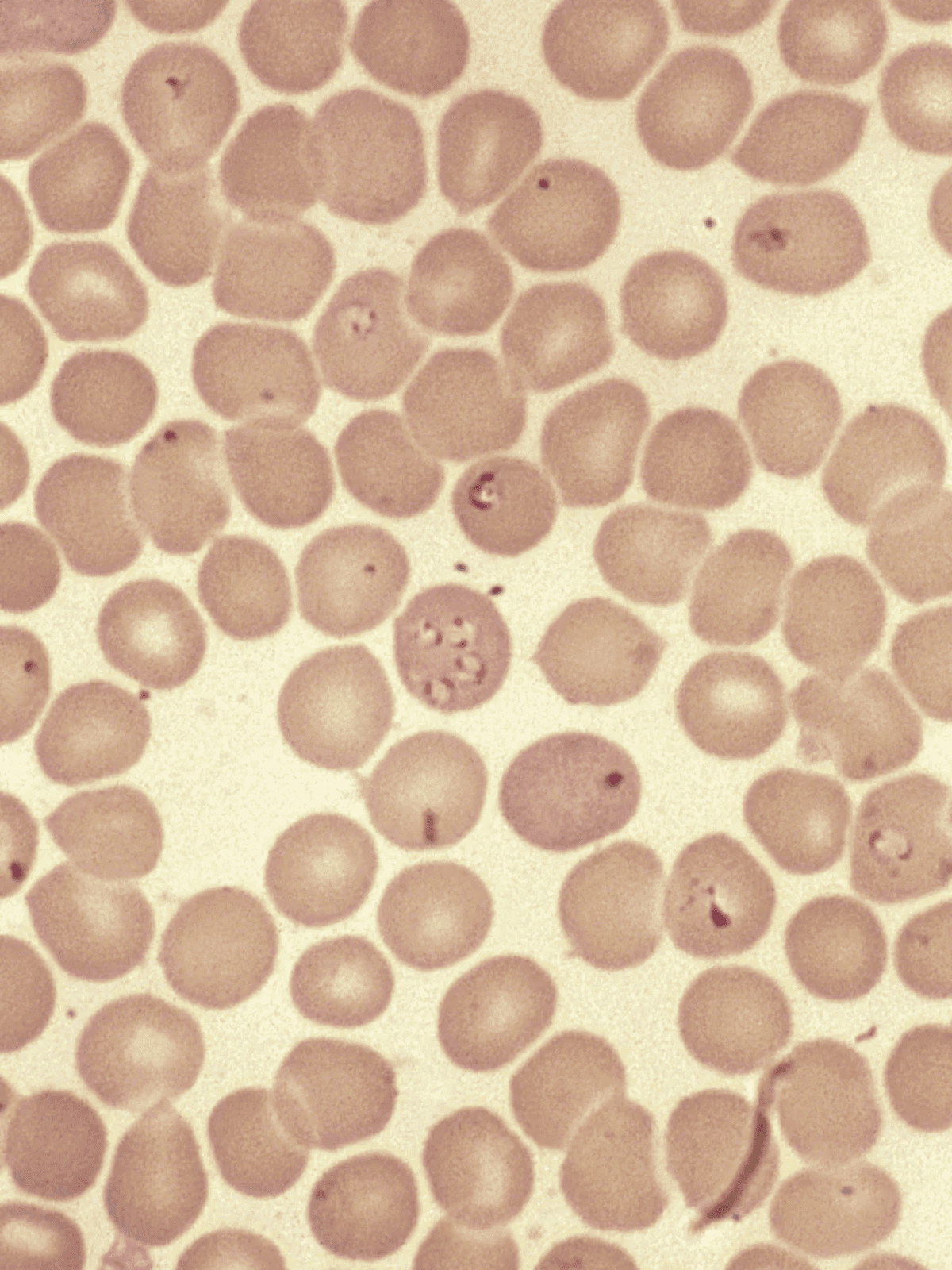 A close-up of blood cells showing healthy, round, and uniform blood cells. Essential for understanding blood health and circulation.