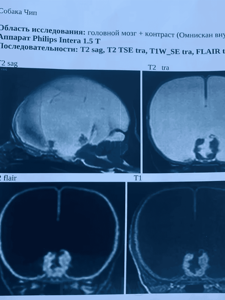 Detailed MRI brain scan images for neurological health assessment.