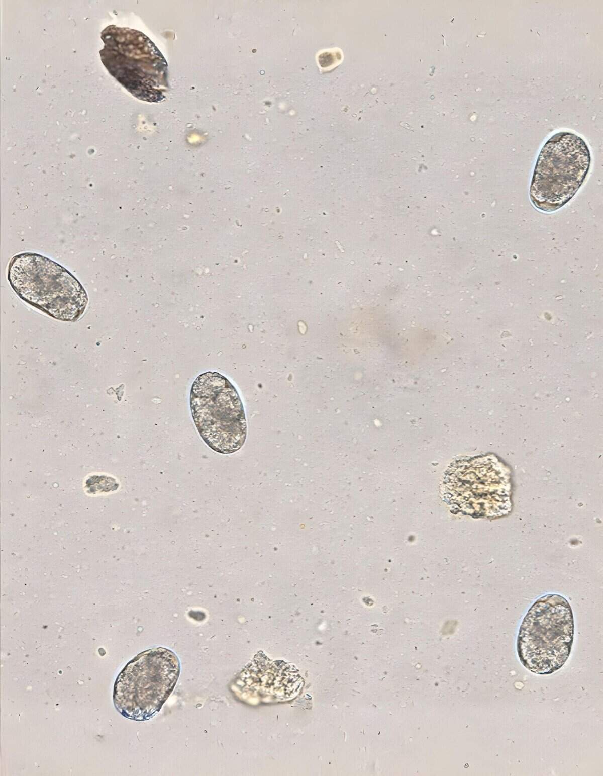 Microscopic view of dog parasite eggs for pet health.