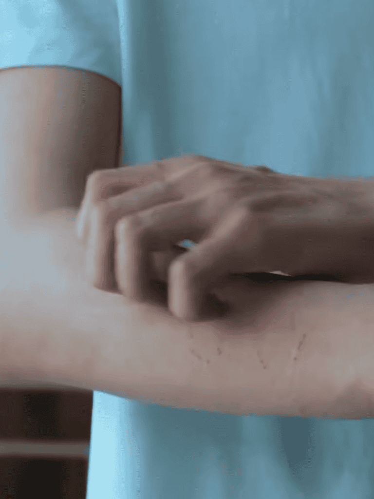 Close-up of arm with scratches and a person’s hand gently touching.